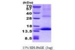 GP9, 17-147aa Human
