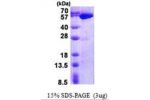 USP14, 1-494aa Human