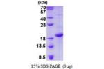 CD83, 20-144aa Human