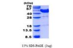 MVK, 1-396aa Human