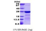 HN1L, 1-190aa Human