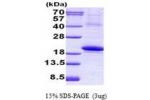 IL18BP, 31-194aa Human