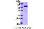 GOT2, 30-430aa Human
