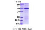 DEDD, 1-318aa Human