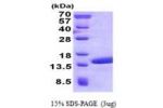 POLR2J2, 1-115aa Human