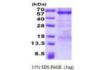 CPE, 43-476aa Human