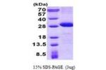 CD226, 19-254aa Human