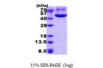 CHI3L1, 1-383aa Human, CHO