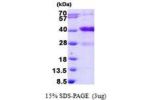 MARCKSL1, 1-195aa, Human