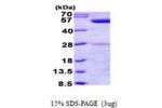 phrB, 1-472aa