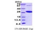 RAB5C, 1-216aa, Human