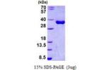 TOR1A, 21-332aa, Human