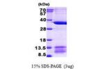 MRPL1, 51-325aa, Human