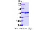 HN1, 1-154aa, Human