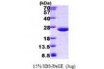 MUP1, 19-180aa, Mouse His tag