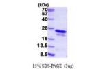 CSDC2, 1-153aa, Human His tag