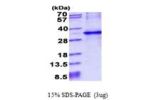 CYB5R1, 29-305aa, Human His tag