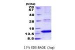LAMTOR2, 1-125aa, Human His tag