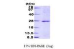 JDP2, 1-163aa, Human His tag