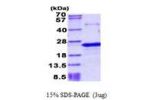 PNOC, 20-176aa, Human His tag