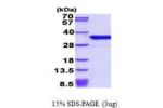 DKK1, 32-266aa, Human His tag
