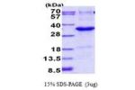 JAZF1, 1-243aa, Human His tag
