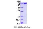 PDZK1, 1-519aa, Human His tag