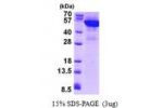 KRT8, 1-483aa, Human His tag