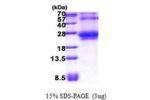 RHOQ, 1-202aa, Human