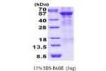ARSA, 21-509aa, Human