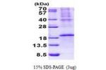 OCIAD2, 1-154aa, Human