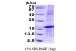 LMO1, 1-156aa, Human