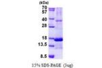 RARRES2, 21-157aa, Human