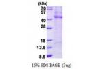 TPST2, 26-377aa, Human