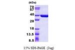 SULT1C4 1-302aa, Human