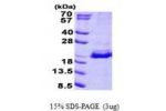 SRP19, 1-144aa, Human