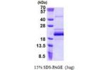 BUD31, 1-144aa, Human