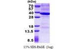 RNASEH2A, 1-299aa, Human