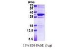 STMN4, 1-216aa, Human