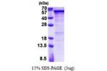 SEMG1, 24-462aa, Human