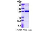 REXO2, 26-237aa, Human