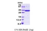 RARRES1, 43-294aa, Human