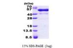 PSTPIP1, 1-416aa, Human