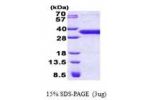 YAE1D1, 1-226aa, Human