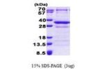 CNOT8, 1-292aa, Human