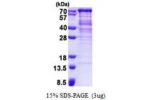 ASPSCR1, 1-553aa, Human