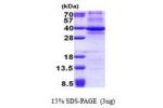 CDK3, 1-305aa, Human