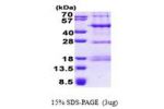 PHF13, 1-300aa, Human