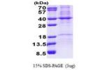 PHB2, 1-299aa, Human
