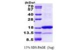 PNRC2, 1-139aa, Human